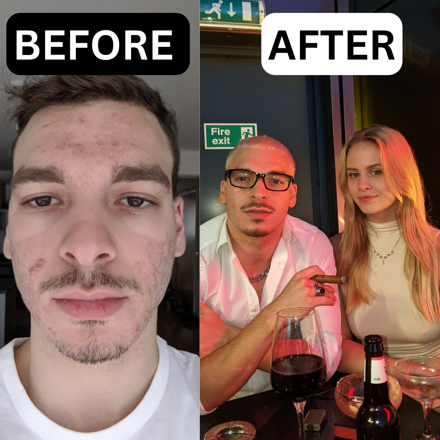 Before and after transformation